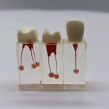 Стоматологическая модель для зубов и упражнений для корневых каналов M8004 с 5 упаковками