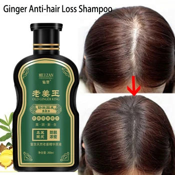 Травяной шампунь Old Ginger King От выпадения волос, Питательный для твердых волос, от клещей, Питательный контроль масла, шампунь от перхоти